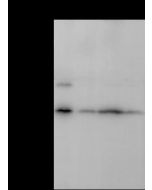Anti-CHMP5 Antibody, Rabbit Polyclonal sinobiological 201939-T32