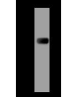 Anti-HIBCH Antibody, Rabbit Polyclonal sinobiological 200594-T44