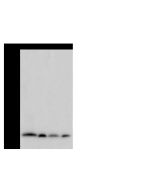 Anti-Beta-2 microglobulin Antibody, Mouse Monoclonal sinobiological 11976-MM34
