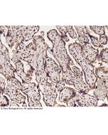 Recombinant Anti-Carbonic Anhydrase VB Antibody, Rabbit Monoclonal sinobiological 12285-R008