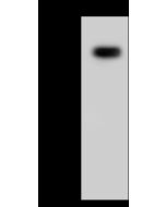 Anti-EIF2B4 Antibody, Rabbit Polyclonal sinobiological 207858-T34
