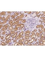 Anti-Glypican 4/GPC4 Antibody, Rabbit Polyclonal sinobiological 200289-T08