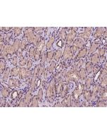 Anti-CSAD Antibody, Rabbit Polyclonal sinobiological 200995-T08