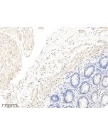 Anti-CALD1/caldesmon Antibody, Rabbit Polyclonal sinobiological 105230-T08