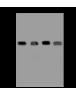 Recombinant Anti-GAPDH Antibody, Rabbit Monoclonal sinobiological 10094-R004