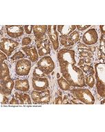 Anti-ABCF2 Antibody, Rabbit Polyclonal sinobiological 101560-T08