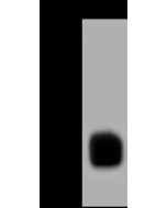 Anti-FAM3C Antibody, Rabbit Polyclonal sinobiological 203107-T40