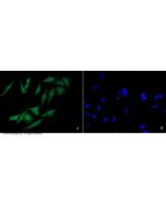 Anti-FANCC Antibody, Rabbit Polyclonal sinobiological 100910-T10