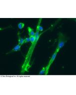 Anti-CD166/ALCAM Antibody, Mouse Monoclonal sinobiological 10045-MM03