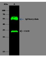 Anti-Carbonic Anhydrase VB Antibody, Rabbit Polyclonal sinobiological 12285-T52