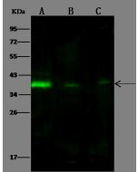 Anti-Calponin/CNN1 Antibody, Rabbit Polyclonal sinobiological 102129-T40