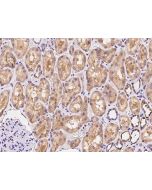 Anti-ARHGAP11A Antibody, Rabbit Polyclonal sinobiological 107604-T08