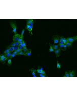 Anti-ACY3/aminoacylase 3 Antibody, Rabbit Polyclonal sinobiological 102759-T10