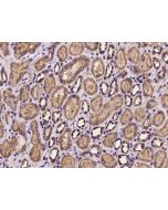 Anti-Dynamitin/DCTN2 Antibody, Rabbit Polyclonal sinobiological 200715-T10