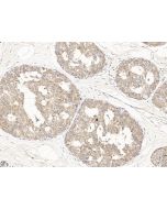 Anti-HMGCR Antibody, Rabbit Polyclonal sinobiological 203920-T08