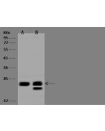 Anti-COMMD8 Antibody, Rabbit Polyclonal sinobiological 201246-T44