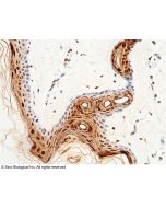 Anti-CALML5 Antibody, Rabbit Polyclonal sinobiological 11783-RP02