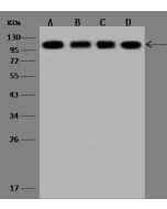 Anti-alpha Actinin 4/ACTN4 Antibody, Rabbit Polyclonal sinobiological 201760-T44