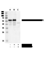 Phospho-cdc25C (Ser216) Antibody, Rabbit MAb sinobiological 111281-R0043