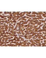 Anti-HSD17B6 Antibody, Rabbit Polyclonal sinobiological 202656-T10