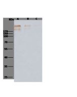 Human cytomegalovirus (HCMV) Glycoprotein B / gB Antibody, Mouse MAb sinobiological 10202-MM02