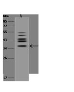 Anti-BPNT1 Antibody, Rabbit Polyclonal sinobiological 201596-T42