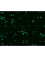 Anti-CD69 Antibody, Rabbit Polyclonal sinobiological 50731-T50