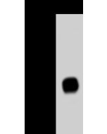 Ebola virus (EBOV) (subtype Zaire, strain H.sapiens-wt/GIN/2014/Kissidougou-C15) VP24 Antibody, Rabbit PAb, Antigen Affinity Purified sinobiological 40454-T62