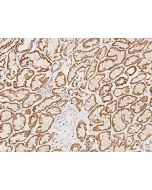 Anti-HRASLS2 Antibody, Rabbit Polyclonal sinobiological 205903-T08