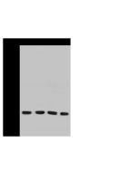 Anti-CD97 Antibody, Rabbit Polyclonal sinobiological 102087-T36