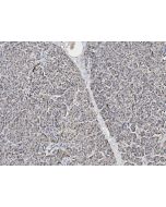 Anti-BCAT1 Antibody, Rabbit Polyclonal sinobiological 107645-T08