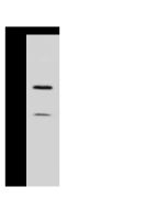 Anti-COMT Antibody, Rabbit Polyclonal sinobiological 107036-T32