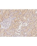 Anti-CHI3L2 Antibody, Rabbit Polyclonal sinobiological 12162-T26