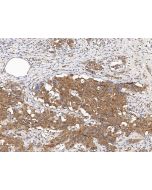 Anti-AKT1S1/PRAS40 Antibody, Rabbit Polyclonal sinobiological 109888-T08
