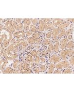 Anti-MKNK1 Antibody, Rabbit Polyclonal sinobiological 207126-T08