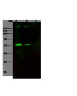 HIV-p51 / RT-p51 (group M, subtype B (isolate HXB2) Gag-Pol polyprotein Antibody, Rabbit PAb, Antigen Affinity Purified sinobiological 40244-T62