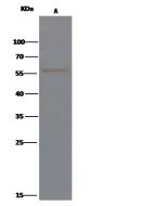 Anti-Carbonic Anhydrase IX/CA9 Antibody, Rabbit Polyclonal sinobiological 70028-T52