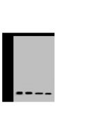 Anti-FKBP12 Antibody, Rabbit Polyclonal sinobiological 202651-T32