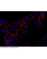 Recombinant Anti-CXADR/CAR Antibody, Rabbit Monoclonal sinobiological 10799-R271