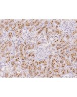 Anti-ACE Antibody, Rabbit Polyclonal sinobiological 206257-T08