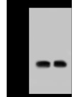 Anti-HMGB1 Antibody, Rabbit Polyclonal sinobiological 100930-T36
