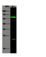 Anti-IL-10 Antibody, Rabbit Polyclonal sinobiological 62000-T48