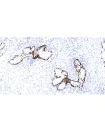 Anti-Human P63 Antibody, Mouse MAb sinobiological IHC059