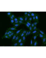 Anti-AGR3 Antibody, Rabbit Polyclonal sinobiological 201972-T02