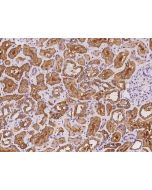 Anti-ALDH1L1 Antibody, Rabbit Polyclonal sinobiological 201548-T08