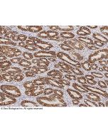 Anti-Carbonic Anhydrase IX/CA9 Antibody, Mouse Monoclonal sinobiological 10107-MM09