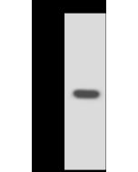 Anti-GNPDA1 Antibody, Rabbit Polyclonal sinobiological 200571-T40
