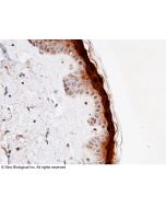 Recombinant Anti-CALML5 Antibody, Rabbit Monoclonal sinobiological 11783-R119