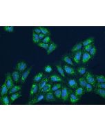 Anti-FBXL12 Antibody, Rabbit Polyclonal sinobiological 207325-T02