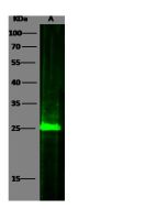 Anti-Hsp27/HSPB1 Antibody, Mouse Monoclonal sinobiological 10351-MM01